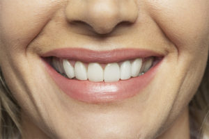 Bouche souriante avec dents blanches